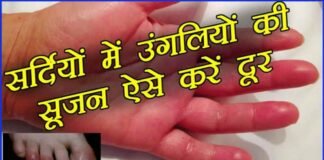 ठंड में आ गई है पैरों की उंगलियों में सूजन, तो अपनाएं ये 7 घरेलू नुस्खे