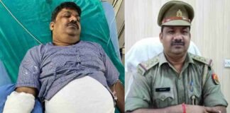 बिजनौर: युवक को बचा रहे SHO पर आवारा कुत्ते ने किया जानलेवा हमला, खा गया एक हाथ की उंगली, पंजा भी जख्मी