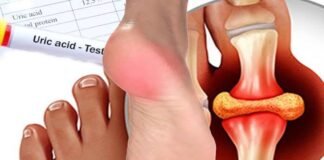 Health Care Tip: शरीर में बढ़ने वाले यूरिक एसिड को बड़ी आसानी से कंट्रोल करते हैं 5 फल, आज ही डाइट में करें शामिल