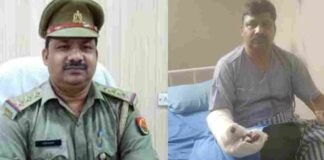 बिजनौर: 6 घंटे तक चले ऑपरेशन में डॉक्टरों ने दोबारा जोड़ी इंस्पेक्टर की कटी उंगली, कुत्ते ने किया था जानलेवा हमला