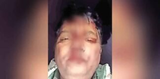 कौशांबी: विवादित भूमि पर निर्माण रोकने गई पुलिस टीम पर पथराव, दारोगा का सिर फटा, सिपाही को भी आईं चोटें