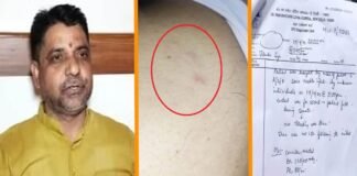 ज्ञानवापी के पैरोकार जितेंद्र विसेन पर को ‘इंजेक्शन’ चुभाकर भागे हमलावर, डॉक्टरों को कोई ‘वायरस’ डालने की आशंका Gyanvapi Jitendra Singh Visen