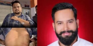 बुलंदशहर: RLD नेता ने पालतू कुत्ते से कराया महिला SDO और JE पर हमला, मारपीट के बाद पिस्टल दिखाकर भगाया Bulandshahr RLD leader