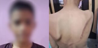 UP: सुबह ‘मदरसे’ की जगह स्कूल चला गया छात्र, ‘जान लेने’ पर तुला मौलवी, बेहोश होने तक पीटा, दोनों हाथ फ्रैक्चर Moradabad