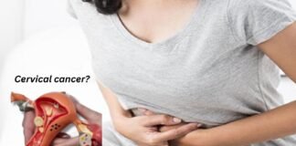 महिलाओं में तेजी से बढ़ रहा सर्वाइकल कैंसर! जानें इसके कारण, लक्षण और बचाव के प्रभावी तरीके