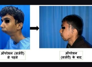UP: AIIMS गोरखपुर में जटिल ऑर्थोग्नाथिक सर्जरी से 22 वर्षीय युवक को दी नई जिंदगी