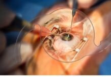 गोरखपुर: न्यू राजेश हाईटेक हॉस्पिटल में मोतियाबिंद सर्जरी के बाद संक्रमण से तबाही, मजिस्ट्रियल जांच में ओटी लापरवाही की पुष्टि – लाइसेंस निरस्त की संस्तुति