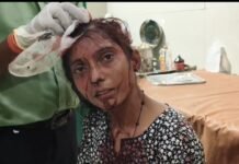 रायबरेली में रक्षा का वादा भूला कलयुगी भाई:जिस हाथ पर बहन ने बांधी थी राखी, उसी हाथ ने बहन के सिर पर मारी कुल्हाड़ी!