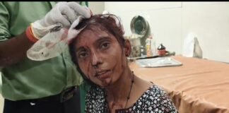 रायबरेली में रक्षा का वादा भूला कलयुगी भाई:जिस हाथ पर बहन ने बांधी थी राखी, उसी हाथ ने बहन के सिर पर मारी कुल्हाड़ी!