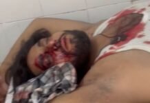 दबंगों ने कार में काम करा रहे भाइयों पर किया हमला, एक की हालत गंभीर, मुरादाबाद रेफर