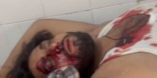 दबंगों ने कार में काम करा रहे भाइयों पर किया हमला, एक की हालत गंभीर, मुरादाबाद रेफर