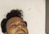 मुरादाबाद में खौफनाक वारदात : 300 रुपए के विवाद में ट्रक चालक ने मैकेनिक के बहनोई को चाकू से गोदा, इलाज के दौरान मौत