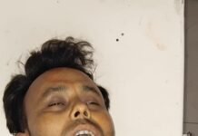 मुरादाबाद में खौफनाक वारदात : 300 रुपए के विवाद में ट्रक चालक ने मैकेनिक के बहनोई को चाकू से गोदा, इलाज के दौरान मौत