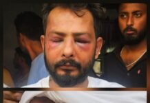 विहिप नगर अध्यक्ष अमित वर्मा पर जानलेवा हमला, गंभीर रूप से घायल