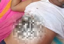 UP: बहराइच में तेंदुए का आतंक, शौच के लिए निकले युवक पर जानलेवा हमला
