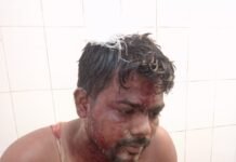 आम तोड़ने के विवाद ने लिया खूनी रूप, फरसा-टांगी से हमला कर युवक का फोड़ा सिर, हालत गंभीर