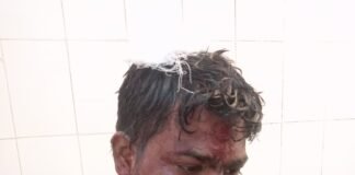 आम तोड़ने के विवाद ने लिया खूनी रूप, फरसा-टांगी से हमला कर युवक का फोड़ा सिर, हालत गंभीर