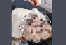 इटावा: इमरजेंसी ब्रेक से हाईवे पर बड़ा हादसा, कंटेनर में घुसा ट्रक, चालक गंभीर रूप से घायल