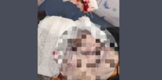 इटावा: इमरजेंसी ब्रेक से हाईवे पर बड़ा हादसा, कंटेनर में घुसा ट्रक, चालक गंभीर रूप से घायल