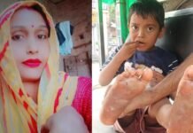 ‘मम्मी मत मारो…’ 5 रुपये के लिए बेरहम मां ने बच्चे के तलवे गर्म चाकू से दागे, कमरे में बंद कर चली गई पार्टी करने!