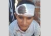घर में घुसकर दबंगई! गाली-गलौज के बाद परिवार पर हमला, 17 वर्षीय किशोरी के सिर में लगे टांके