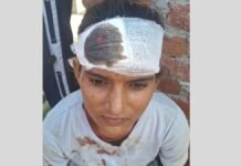 घर में घुसकर दबंगई! गाली-गलौज के बाद परिवार पर हमला, 17 वर्षीय किशोरी के सिर में लगे टांके