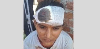 घर में घुसकर दबंगई! गाली-गलौज के बाद परिवार पर हमला, 17 वर्षीय किशोरी के सिर में लगे टांके