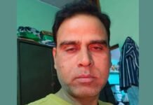 UP: नीलगाय बनी काल, पांच दिन में उजड़ गया पूरा परिवार, हादसे में पिता समेत दो बेटों की मौत