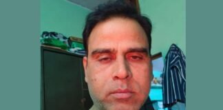 UP: नीलगाय बनी काल, पांच दिन में उजड़ गया पूरा परिवार, हादसे में पिता समेत दो बेटों की मौत