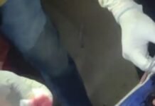 UP: सरकारी रास्ते को कंटीले तार से घेरने पर विवाद, युवक से मारपीट, सिर में ईंट मारने और गला दबाने का आरोप