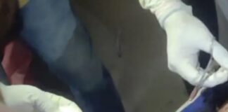 UP: सरकारी रास्ते को कंटीले तार से घेरने पर विवाद, युवक से मारपीट, सिर में ईंट मारने और गला दबाने का आरोप