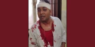 UP: जौनपुर ग्राम विकास अधिकारी पर हमले का आरोप, लोहे की रॉड और लाठी-डंडों से मारपीट की शिकायत
