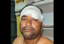 UP: पुरानी रंजिश में गाली-गलौज के बाद लात-घूंसों से हमला, सिर और भौंह में चोट