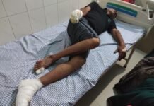 कॉलोनी में मौत बनकर दौड़ रहा 33 हजार वोल्ट का तार! जौनपुर में पिता-पुत्र समेत तीन झुलसे