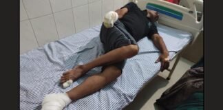 कॉलोनी में मौत बनकर दौड़ रहा 33 हजार वोल्ट का तार! जौनपुर में पिता-पुत्र समेत तीन झुलसे