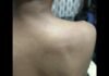 UP: बहन से अश्लील हरकत का विरोध करना पड़ा भारी, समाचार पत्र विक्रेता की लाठी-डंडों से पिटाई, मामला दर्ज