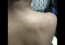 UP: बहन से अश्लील हरकत का विरोध करना पड़ा भारी, समाचार पत्र विक्रेता की लाठी-डंडों से पिटाई, मामला दर्ज