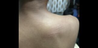 UP: बहन से अश्लील हरकत का विरोध करना पड़ा भारी, समाचार पत्र विक्रेता की लाठी-डंडों से पिटाई, मामला दर्ज