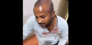Raebareli: रायबरेली में कहासुनी के बाद युवक पर टूट पड़े हमलावर, लाठी-डंडों से पीटकर किया घायल, पुलिस जांच में जुटी