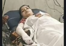 पीलीभीत में दहेज की मांग पूरी न होने पर नवविवाहिता को जिंदा जलाने की कोशिश, हालत नाजुक